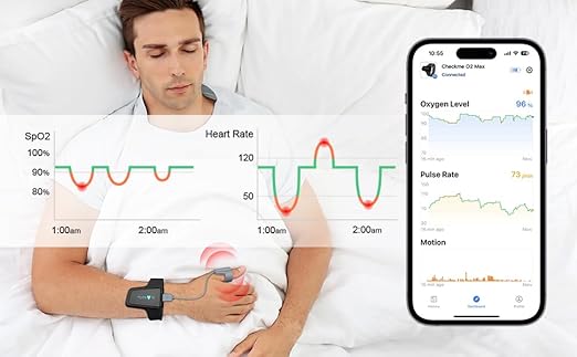 Wellue O2 Pulse Oximeter with Smart Reminder | Blood Oxygen Saturation Monitor for SpO2 and Heart Rate Tracking Continuously, Bluetooth Finger Ring with Free APP &PC Report, Style 1