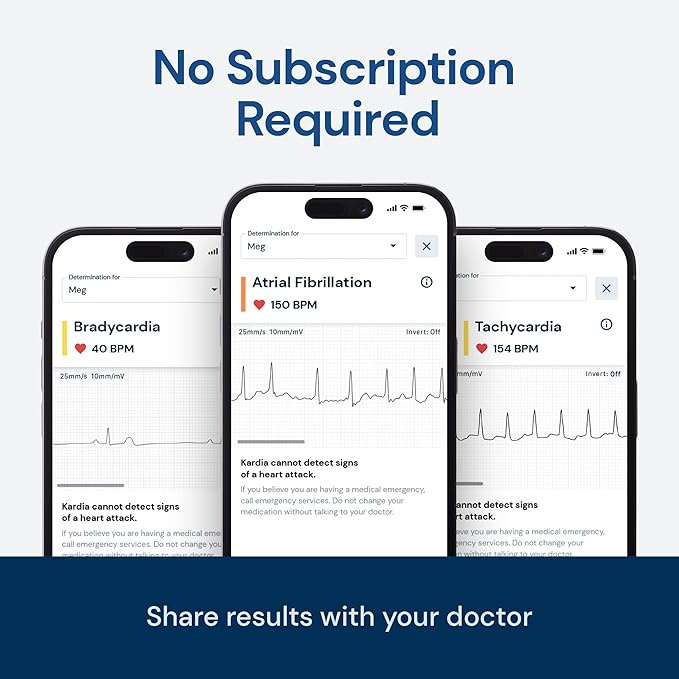 KardiaMobile 1-Lead EKG Monitor, Medical-Grade FDA-Cleared Personal Heart Monitor, Detects Normal, AFib & Arrhythmias, 30 Second Results, Works with Smartphones, Pocket Size, No Subscription Required
