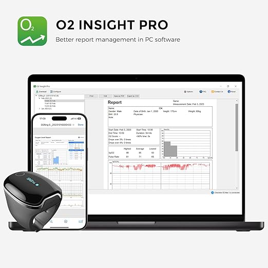 Wellue O2Ring-S Oxygen Monitor for Small Fingers | Rechargeable Pulse Oximeter, Continuous Blood Oxygen & Pulse Rate Tracking with Vibration Reminder | 24 hrs Battery Life, 4 * 10 Hours Data Storage