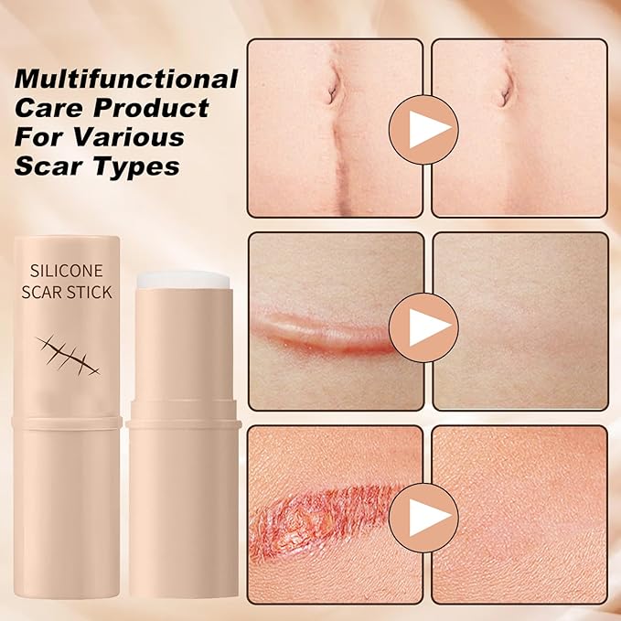 2PCS Scar Solutions Silicone Scar Stick, Silicone Scar Stick, Contains 60% Silicone, Easy-to-Use Stick Design, Manual Massage Applicator for Face and Body, Suitable for All Skin Types