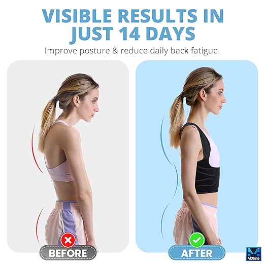 Posture Corrector for Women & Men – Adjustable Back Brace for Alignment, Pain Relief & Back Support – Premium Back Posture Trainer for Improved Posture