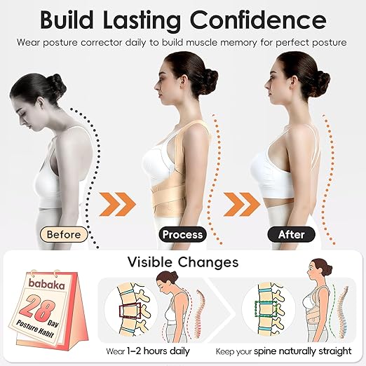 babaka Posture Corrector for Women, Invisible Lightweight Adjustable Back Brace for Upper and Lower Back Pain Relief, Hunchback, Hump, Scoliosis, Thoracic, Spine Corrector Under Clothes (Beige, Small, Waist: 25''-30'')